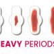 Mygyno Kenya- Heavy Periods